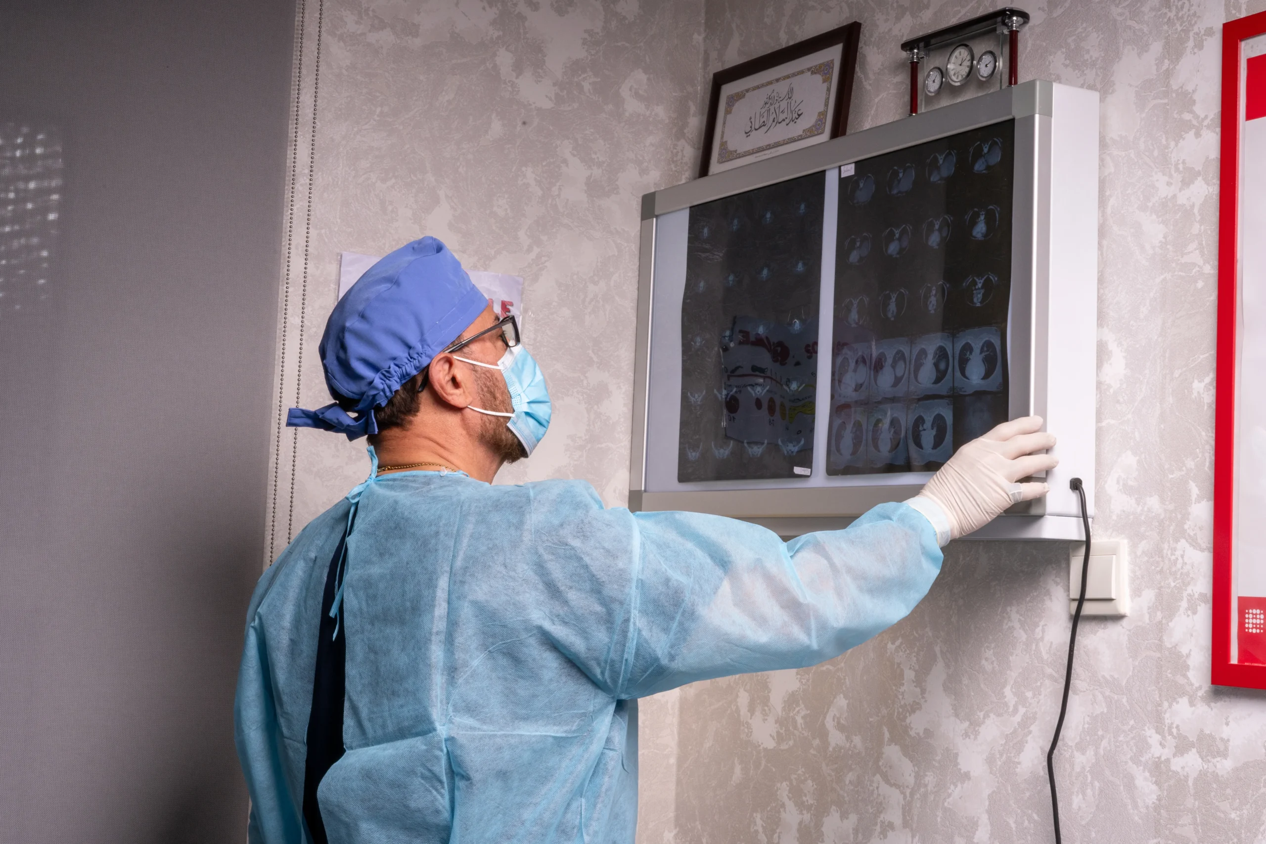 Laparoscopic Mini Bypass