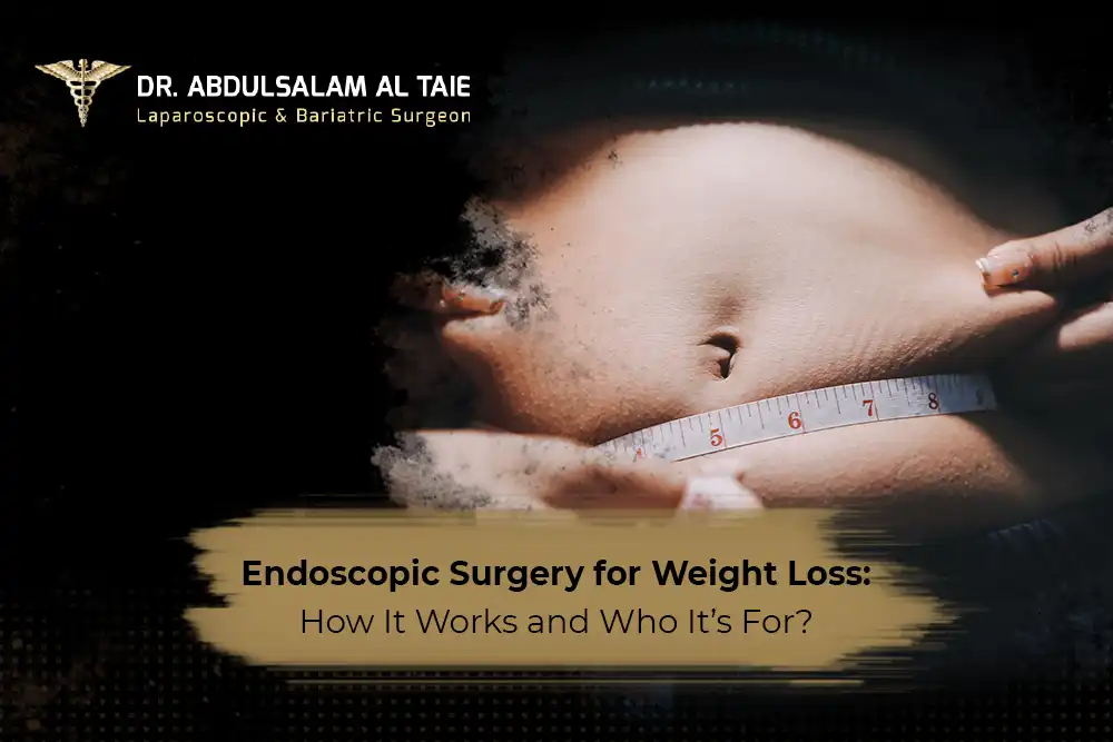 endoscopic sleeve gastroplasty dubai