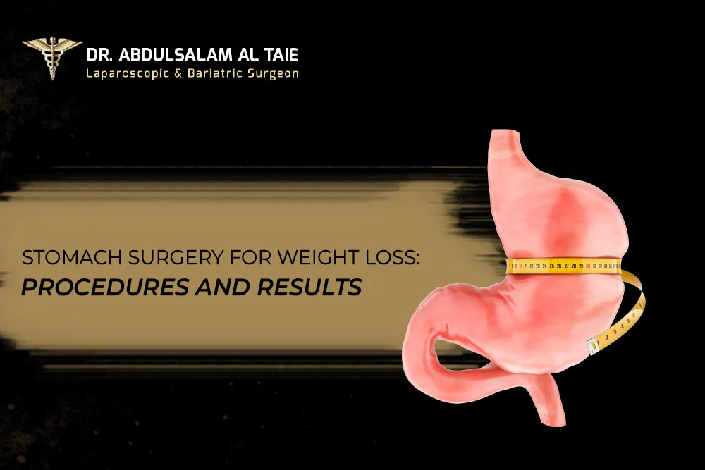 Stomach Surgery for Weight Loss: Procedures and Results