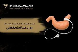عملية حلقة المعدة بالمنظار وميزاتها مع د. عبد السلام الطائي