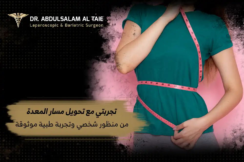 تجربتي مع تحويل مسار المعده