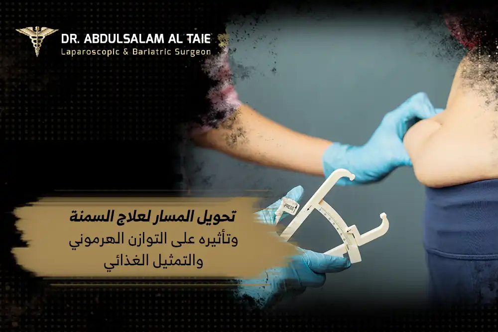 تحويل المسار لعلاج السمنة