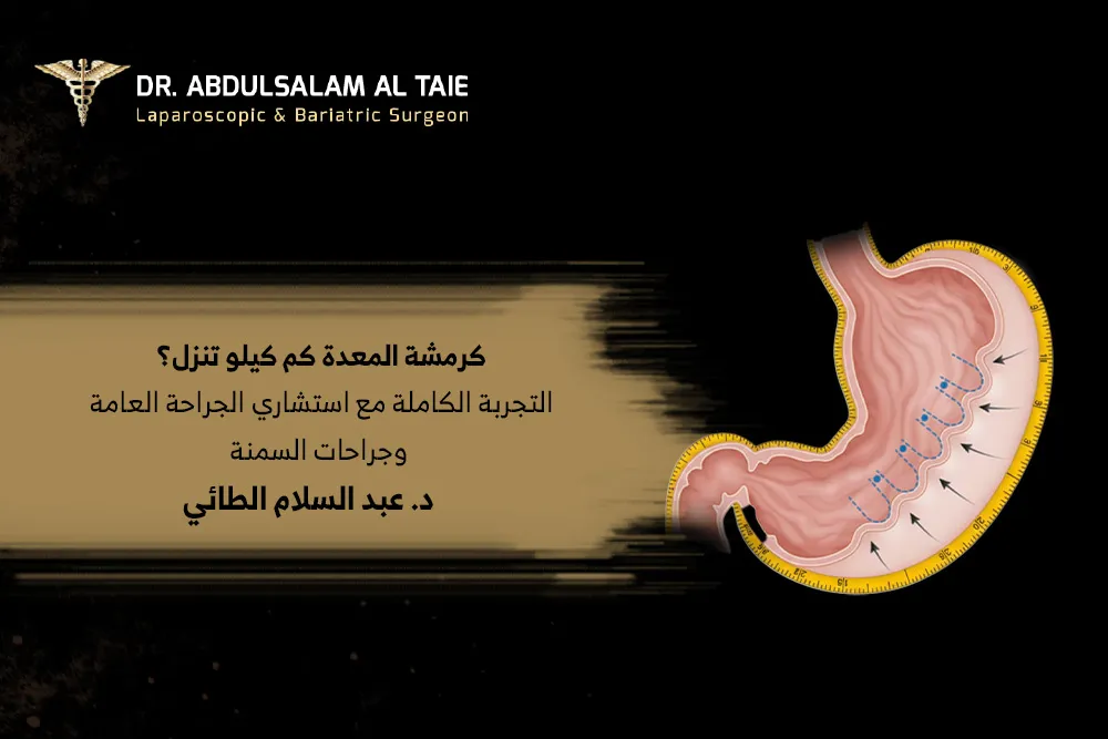 كرمشة المعدة كم كيلو تنزل