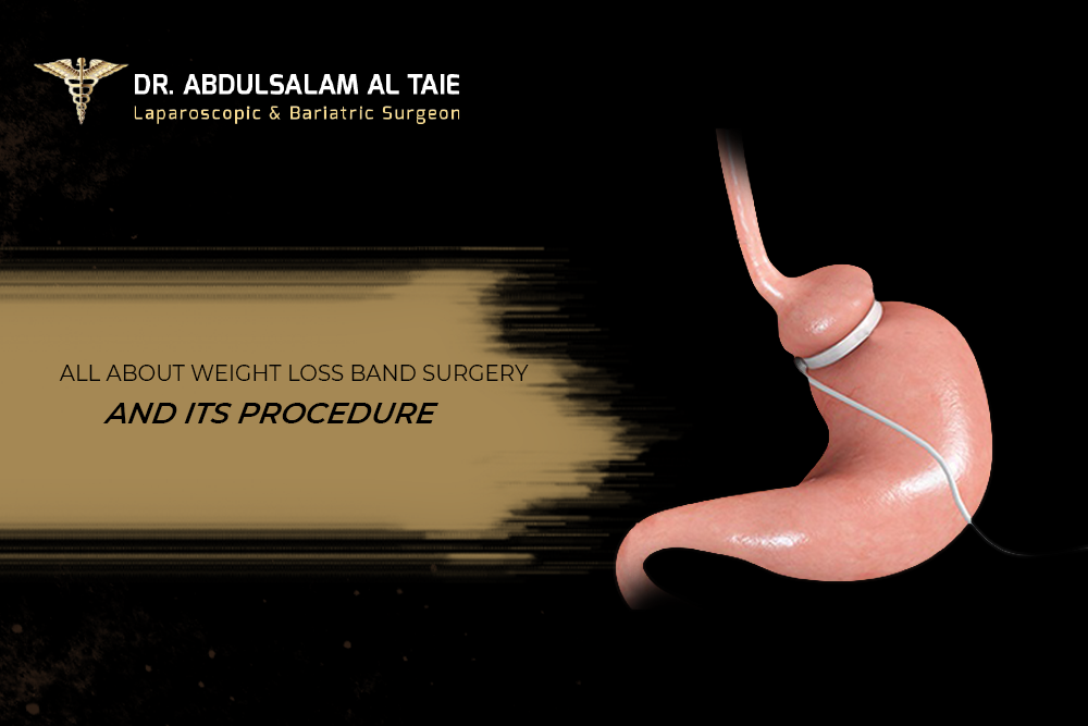 weight loss band surgery