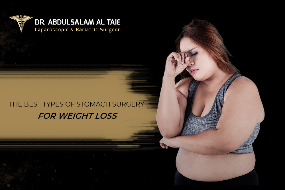 types of stomach surgery for weight loss