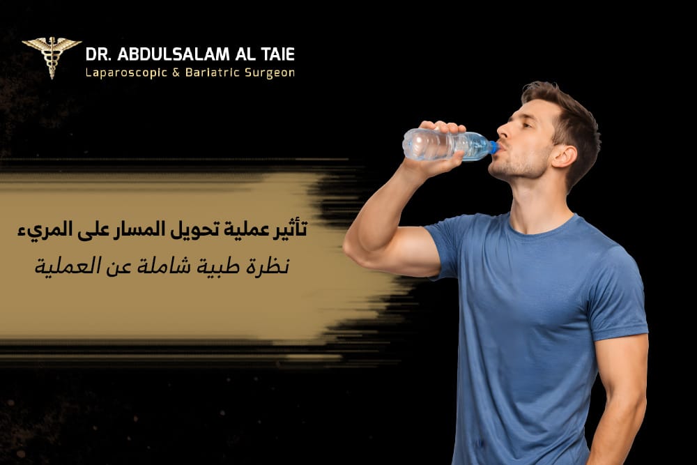 تأثير عملية تحويل المسار على المريء تأثير عملية تحويل المسار على المريء