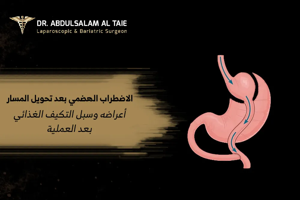 الاضطراب الهضمي بعد تحويل المسار