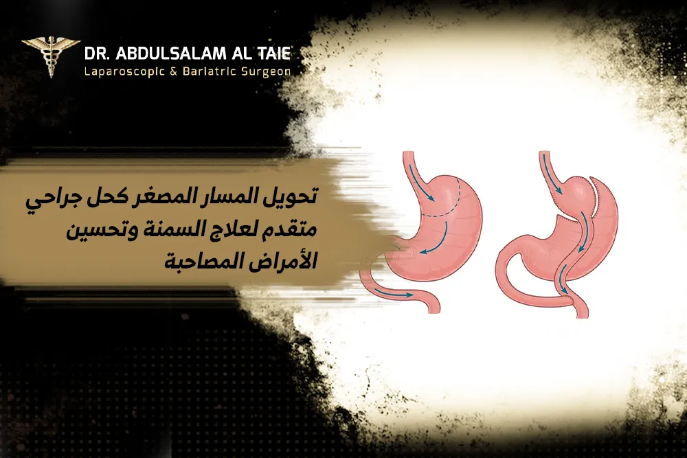 تحويل المسار المصغر