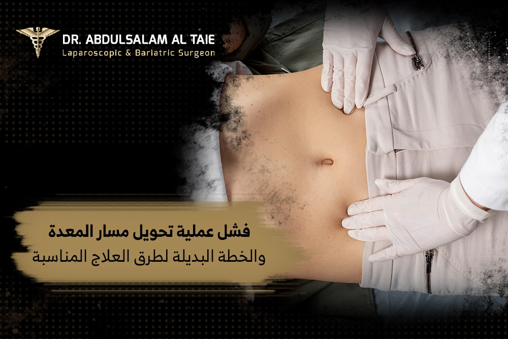 فشل عملية تحويل مسار المعدة فشل عملية تحويل مسار المعدة