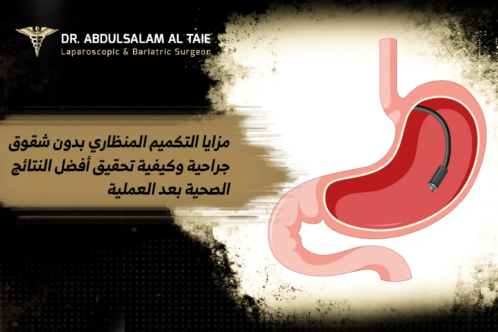 التكميم المنظاري بدون شقوق جراحية