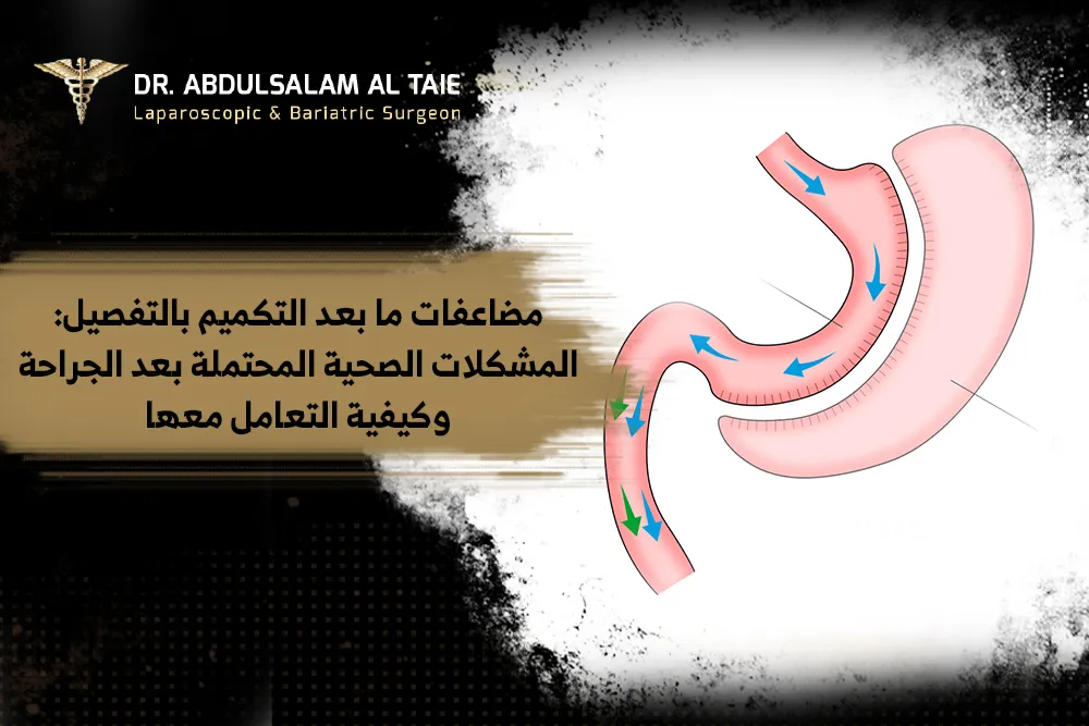 مضاعفات ما بعد التكميم مضاعفات ما بعد التكميم