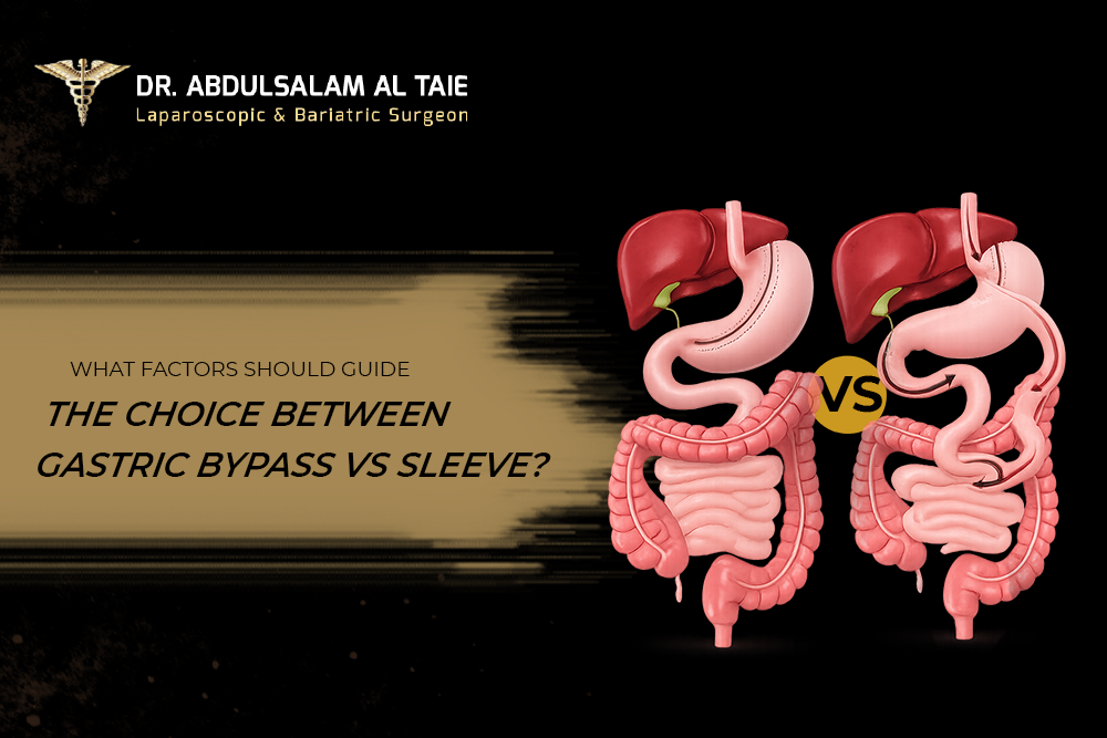 Gastric Bypass vs Sleeve